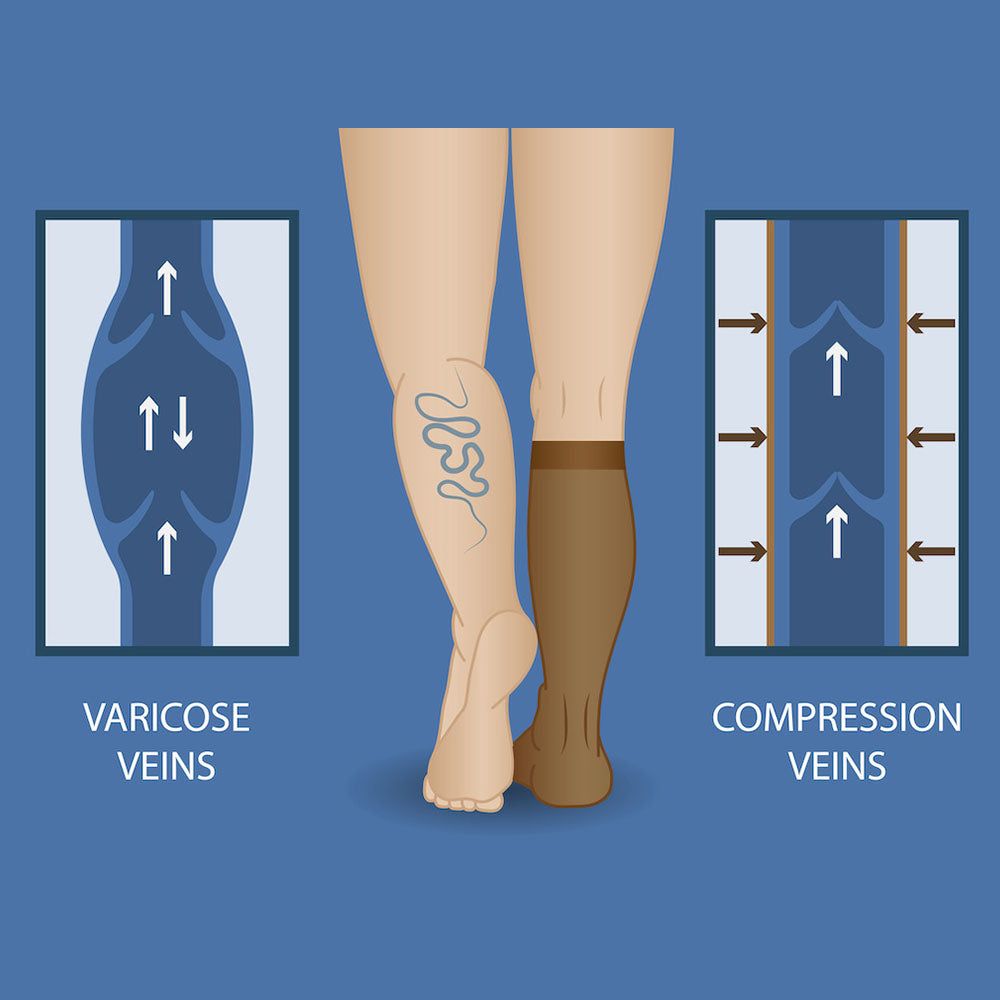 Best Medical Compression Socks for Circulation – Improve Blood Flow and Relieve Symptoms