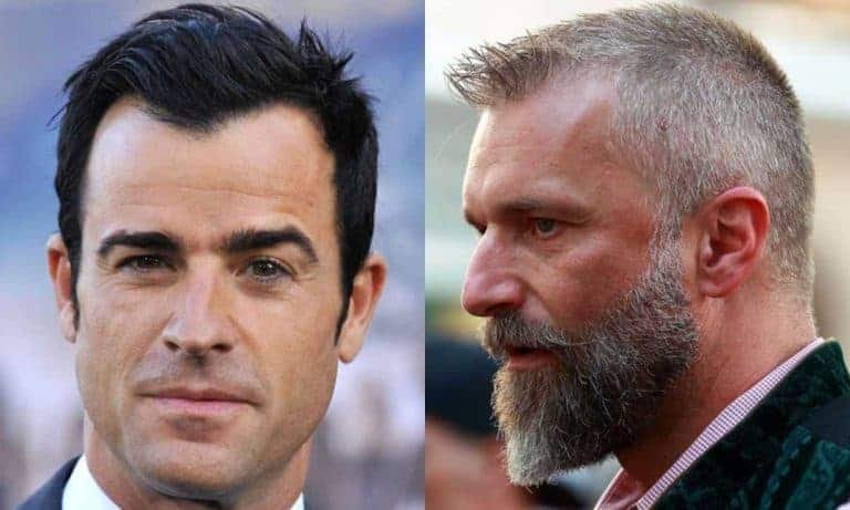 Best Hairstyles for Hair Thinning on Men