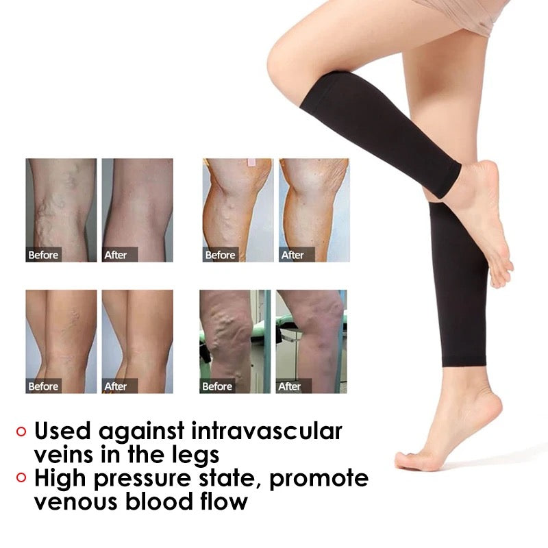 Best Compression Socks for Varicose Veins