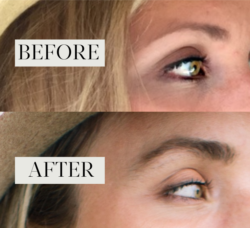 Best eyebrow growth serum