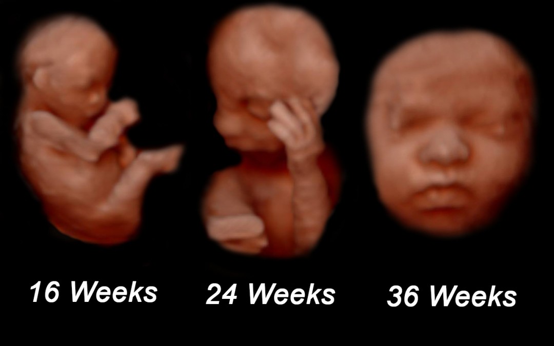 When is the Best Time to Get a 3D Ultrasound? - Mother Nurture Ultrasound Best time to get 3d ultrasound
