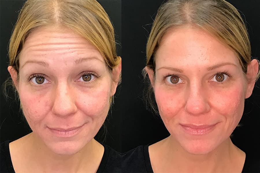 Best place to get botox near me offers top-notch dermatologists specializing in facial rejuvenation.