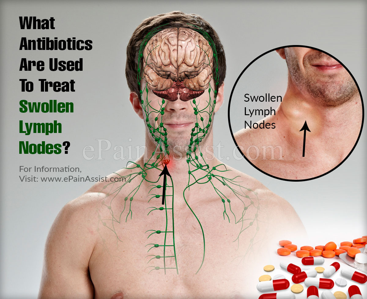 What Antibiotics Are Used To Treat Swollen Lymph Nodes? What Antibiotics Are Used To Treat Swollen Lymph Nodes?